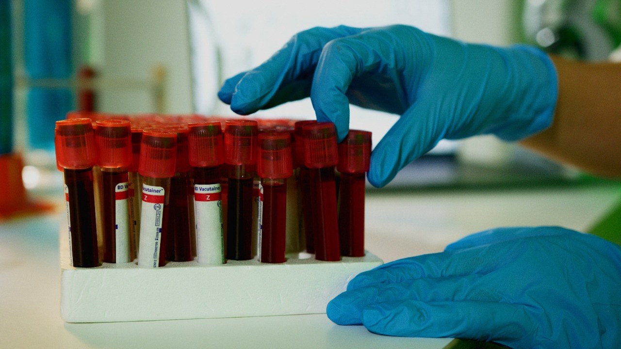 People whose data was exposed at a lab serving Planned Parenthood affiliates can claim from a $6.1 million fund by Nov. 24